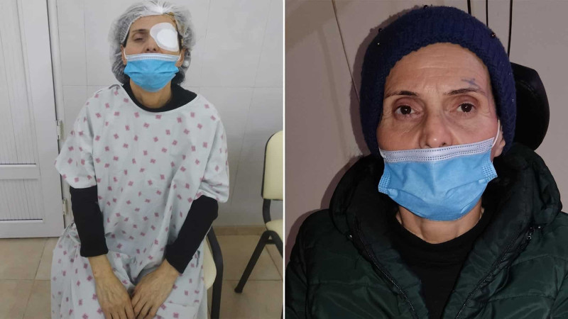 Sumqayıt şəhər sakininə ödənişsiz əməliyyat edilib