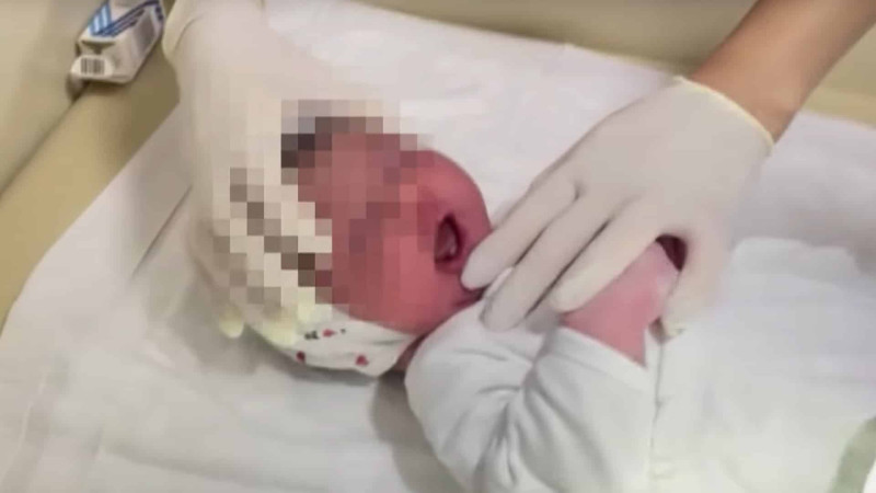 Sumqayıt xəstəxanasında dişli körpə doğuldu