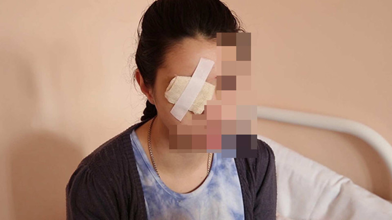 Sumqayıtda kişi arvadının gözünü çıxardığına görə həbs olunub