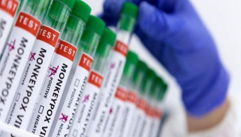 Meymunçiçəyinin əsas ƏLAMƏTLƏRİ