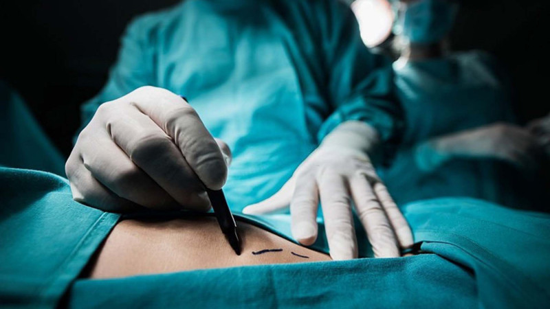 Nazirdən plastik cərrahların fəaliyyəti ilə bağlı açıqlama - Yoxlama bu tarixdə bitir