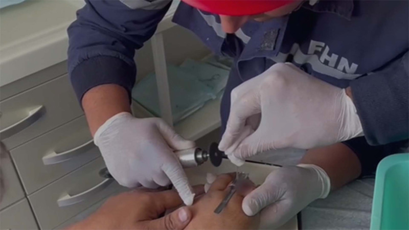 Sumqayıt sakininin dəmir halqa problemi həll edildi