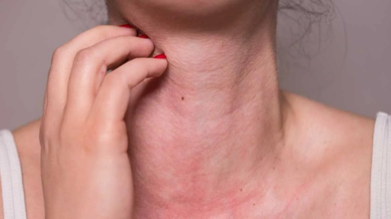 “Pambıq” yağışı - Sumqayıtda ALLERGİYA artır - VİDEO