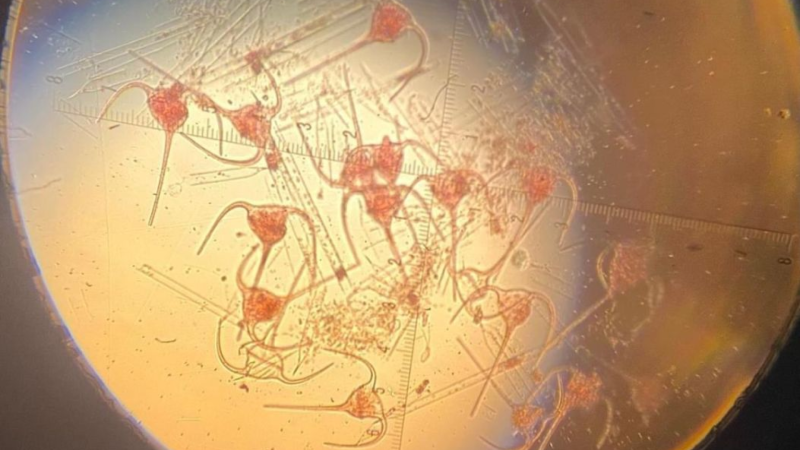 Xəzərdə yeni canlı məskunlaşıb - ALİMLƏR NARAHATDIR