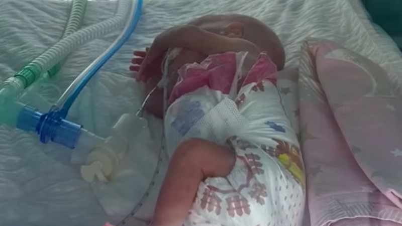 Həyata NUR saçan körpə: 540 qramlıq möcüzə