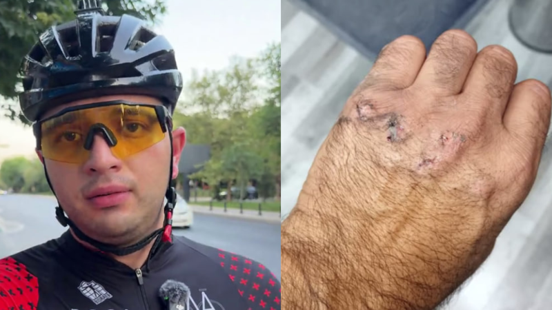 Sumqayıtda avtobus sürücüsü təhlükəli manevr etdi - Velosipedçi yaralandı