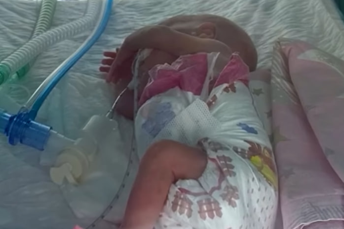 Həyata NUR saçan körpə: 540 qramlıq möcüzə