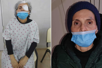 Sumqayıt şəhər sakininə ödənişsiz əməliyyat edilib