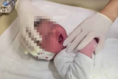 Sumqayıt xəstəxanasında dişli körpə doğuldu