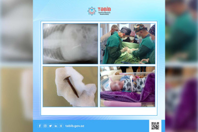 Yad cismi udan körpə əməliyyat olunub