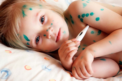 Məktəblilər arasında suçiçəyi yayılıb