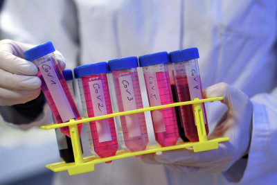 Yeni yayılan virus koronavirusdan TƏHLÜKƏLİDİR?