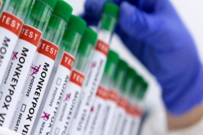 Meymunçiçəyinin əsas ƏLAMƏTLƏRİ