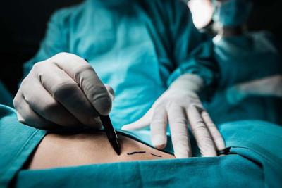 Nazirdən plastik cərrahların fəaliyyəti ilə bağlı açıqlama - Yoxlama bu tarixdə bitir