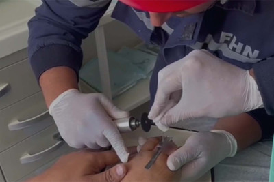 Sumqayıt sakininin dəmir halqa problemi həll edildi