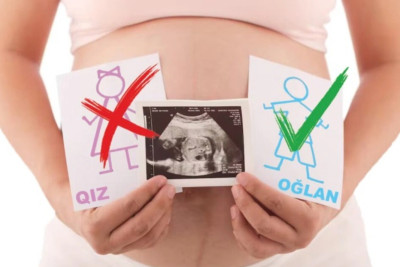 STM-in direktor müavini: “Selektiv abortlar qanunsuzdur”