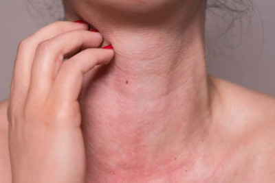 “Pambıq” yağışı - Sumqayıtda ALLERGİYA artır - VİDEO