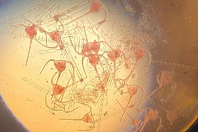 Xəzərdə yeni canlı məskunlaşıb - ALİMLƏR NARAHATDIR