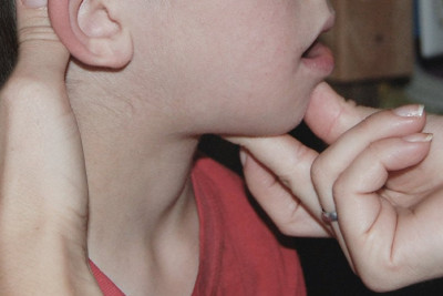 "Çöp qalma" MİFİ – Müasir tibb YOX, xalq ÜSULU?